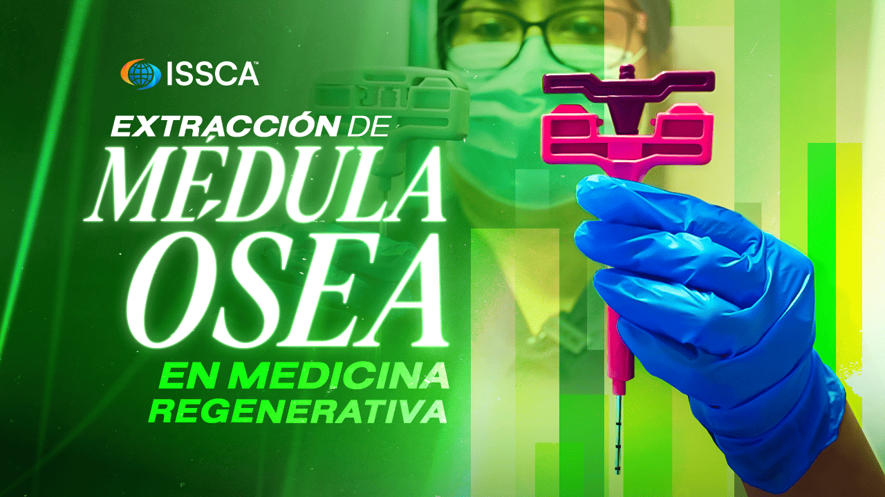 🔬 Extracción de Médula Ósea en Medicina Regenerativa